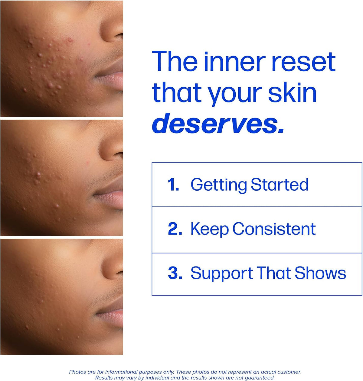 clarity³ — Triple-Action Skin Support with DIM, Probiotics & Zinc