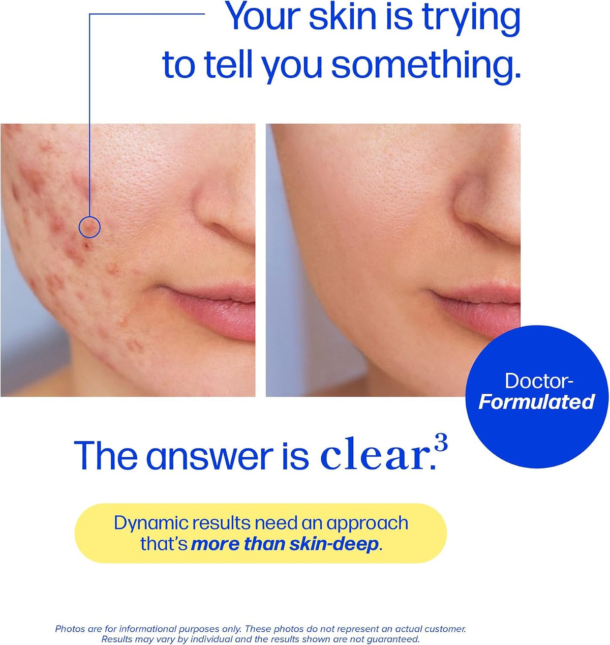 clarity³ — Triple-Action Skin Support with DIM, Probiotics & Zinc